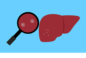 liver, bacteria, virus-5669876.jpg